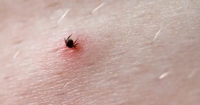 Даже если паразит чист от возбудителей, укусы могут доставлять и другие неприятности. Ведь во время питания он нарушает кожные покровы, оставляя глубокие открытые ранки