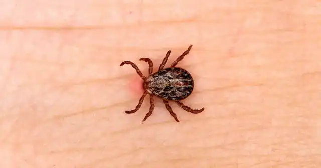Клещ на коже