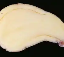 Кольцевая гниль картофеля