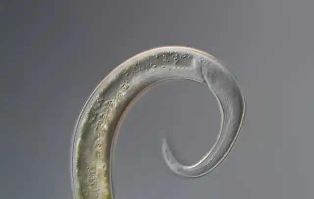 Нематода под микроскопом