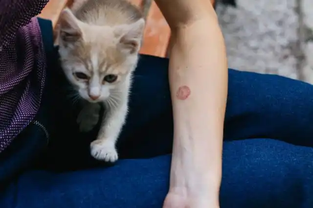 Стригущий лишай с лёгкостью передаётся человеку от больных животных при обычном поглаживании