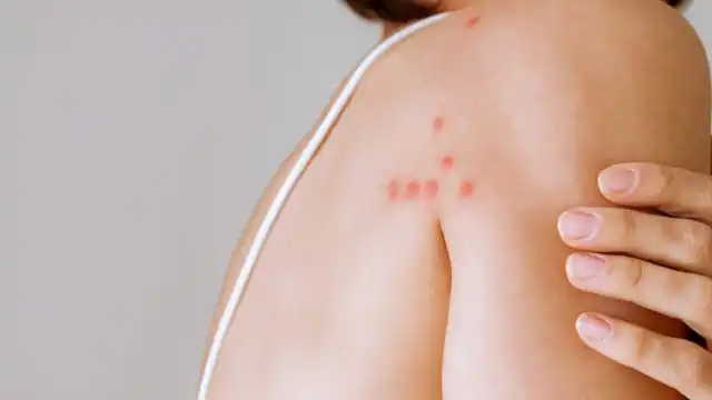 Как и некоторые кровососущие насекомые, они могут передавать возбудителей болезней от одного хозяина к другому.