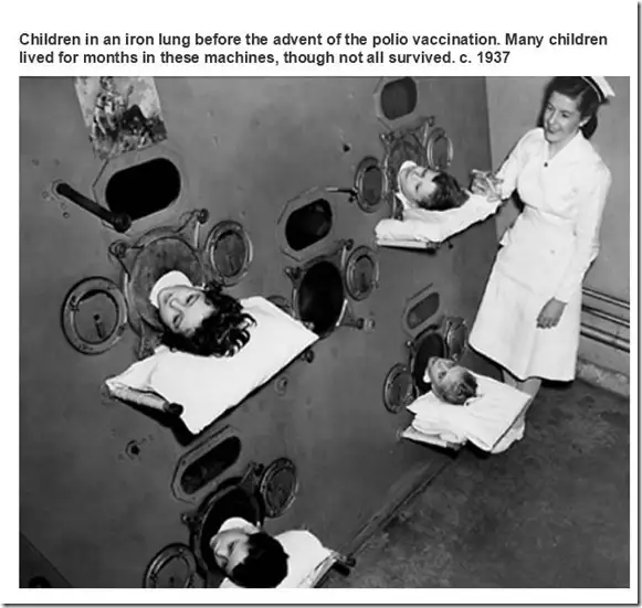 Спроба лікування поліомеліта